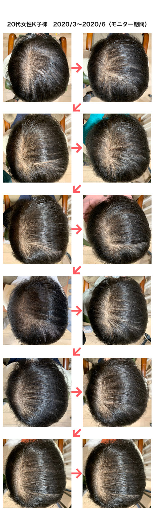 ビフォーアフター写真